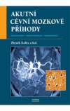 Akutní cévní mozkové příhody