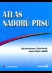 Atlas nádorů prsu