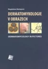 Dermatomykologie v obrazech