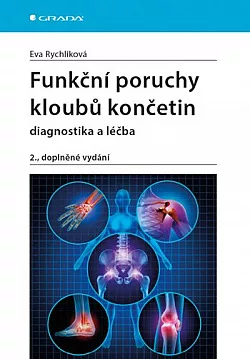 Funkční poruchy kloubů končetin diagnostika a léčba