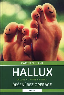 Hallux – řešení bez operace