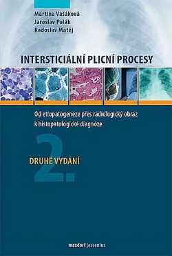 Intersticiální plicní procesy