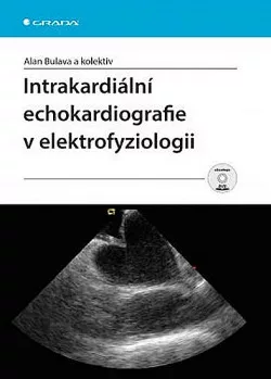 Intrakardiální echokardiografie v elektrofyziologii