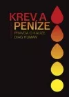 Krev a peníze: Pravda o kauze Diag Human
