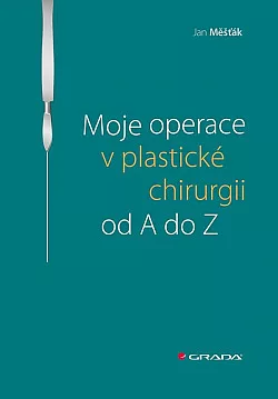 Moje operace v plastické chirurgii od A do Z