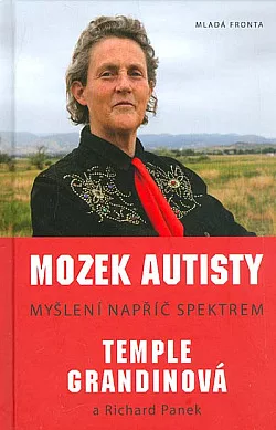 Mozek autisty
