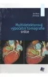 Multidetektorová výpočetní tomografie srdce
