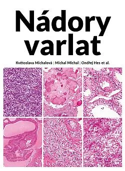 Nádory varlat