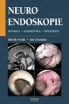 Neuroendoskopie