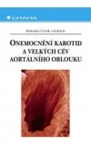 Onemocnění karotid a velkých cév aortálního oblouku