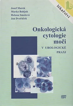 Onkologická cytologie moči