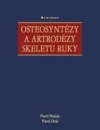 Osteosyntézy a artrodézy skeletu ruky