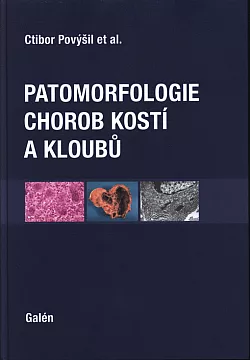 Patomorfologie chorob kostí a kloubů