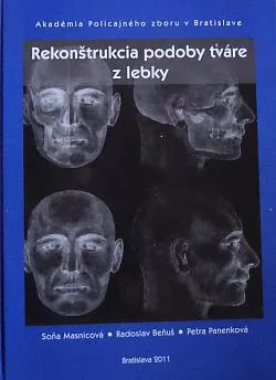 Rekonštrukcia podoby tváre z lebky
