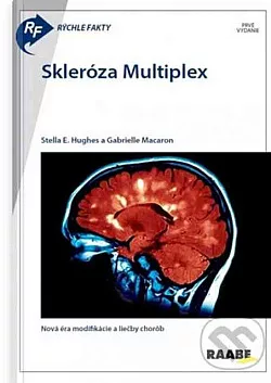 Rýchle fakty: Skleróza multiplex