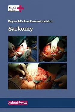 Sarkomy