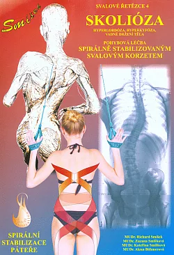 Skolióza - Svalové řetězce 4
