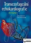 Transezofageální echokardiografie do kapsy