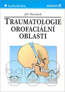Traumatologie orofaciální oblasti