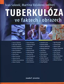 Tuberkulóza ve faktech i obrazech