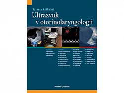 Ultrazvuk v otorinolaryngologii
