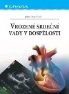 Vrozené srdeční vady v dospělosti
