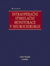Intraoperační stimalační monitorace v neurochirurgii