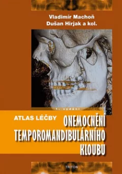 Atlas léčby onemocnění temporomandibulárního kloubu