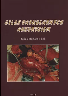 Atlas vaskulárnych aneuryziem