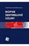 Biopsie sentinelové uzliny