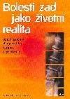 Bolesti zad jako životní realita