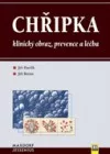 Chřipka: Klinický obraz, prevence a léčba