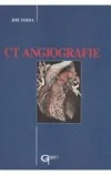 CT angiografie