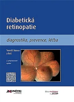 Diabetická retinopatie