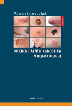 Diferenciální diagnostika v dermatologii