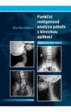 Funkční rentgenová analýza páteře s klinickou aplikací