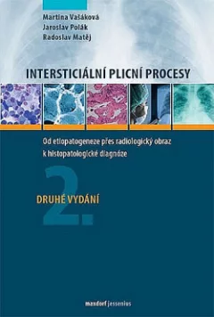 Intersticiální plicní procesy