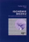 Ischémie mozku