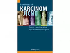 Karcinom jícnu