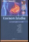 Karcinom žaludku