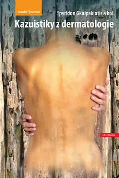 Kazuistiky z dermatologie