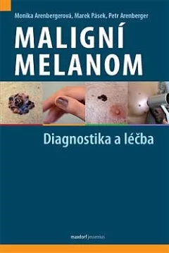 Maligní melanom – Diagnostika a léčba
