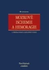 Mozkové ischemie a hemoragie