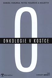 Onkologie v kostce