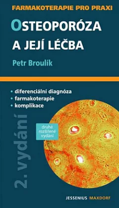 Osteoporóza a její léčba