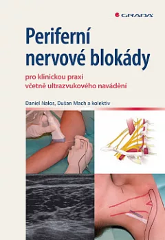 Periferní nervové blokády