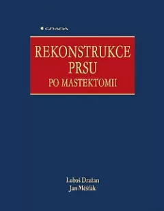 Rekonstrukce prsu po mastektomii