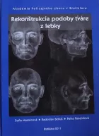 Rekonštrukcia podoby tváre z lebky