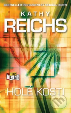 Holé kosti