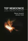 Tep nemocnice